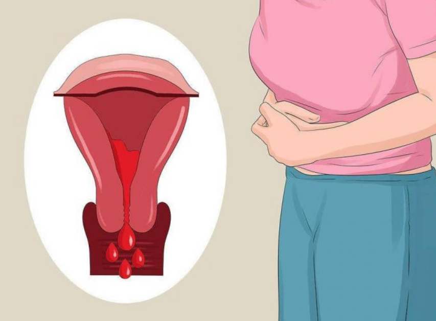 menstruasyon-nedir 