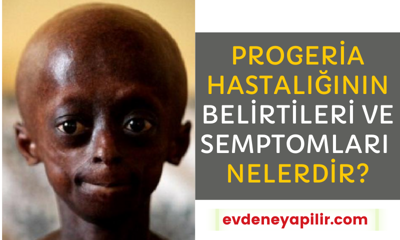 progeria-hastaligi-sendromu-nedir-neden-olur-belirtileri